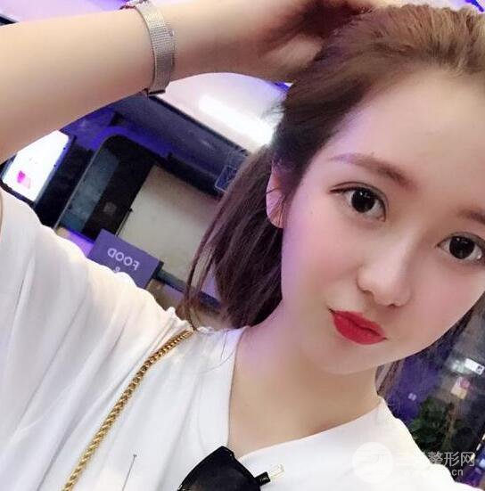 長得太著急是怎樣一種體驗？妹子血淚分享自體脂肪填充詳細(xì)部年輕化經(jīng)驗