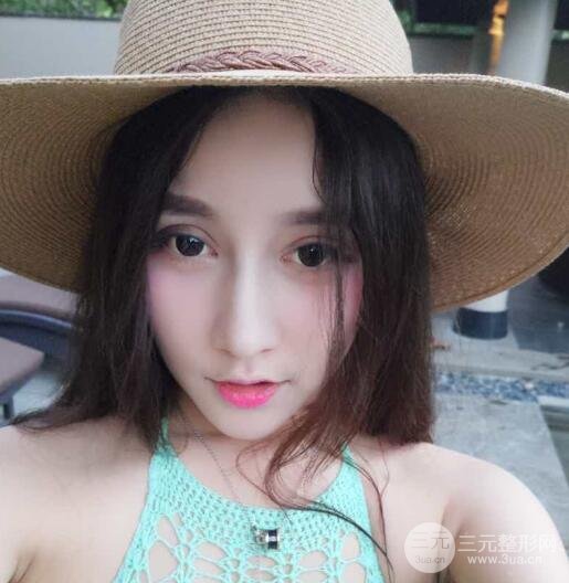 深圳源美做隆鼻失敗修復(fù)價格案例