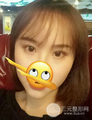 武漢天申胡麗醫(yī)生發(fā)際線種植真實(shí)案例，并附上前后對比圖片