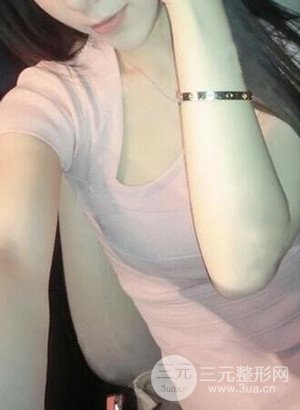 武漢繹君毛林醫(yī)生給我做的假體隆胸手術(shù)，分享一下前后對(duì)比圖