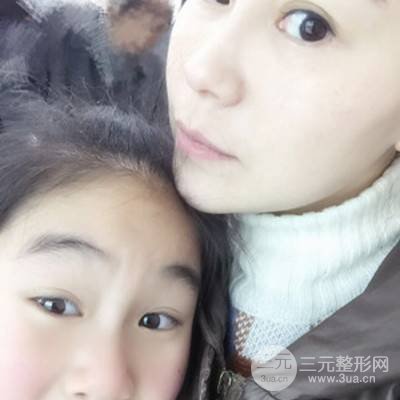 武漢美侖陳遠(yuǎn)海自體脂肪填充全臉案例，附上前后對(duì)比圖片