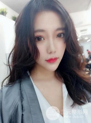 自體脂肪填充額頭+豐下巴真實案例，昆明都市儷人金海坤醫(yī)生做的