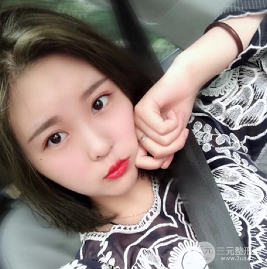面部光纖溶脂三個月恢復記錄，妹子終于擺脫大臉盤子辣