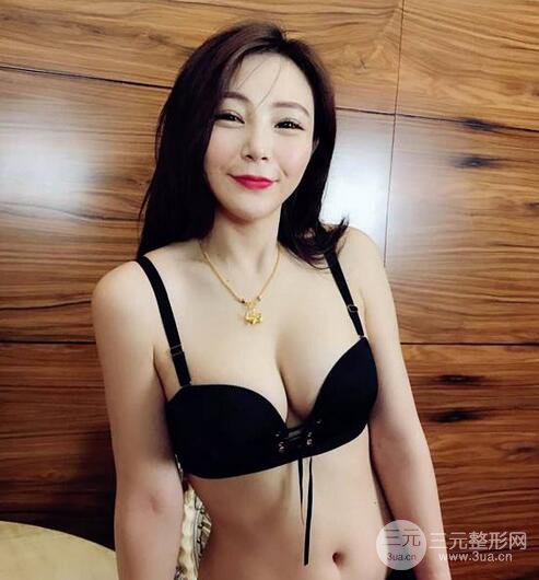 自體脂肪豐胸3個(gè)月分享，活細(xì)胞豐胸術(shù)后果逼真更自然