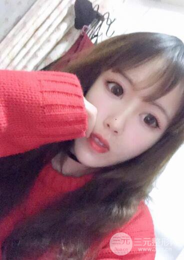 自體脂肪填充全臉基本換臉，改臉型不只是磨骨才能做到！