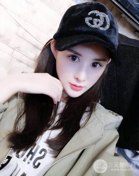 【隆鼻失敗修復(fù)】自體脂肪隆鼻隆鼻整形拯救之后可以隨意揉捏！