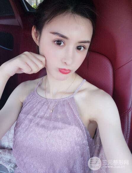 【隆鼻失敗修復(fù)】自體脂肪隆鼻隆鼻整形拯救之后可以隨意揉捏！