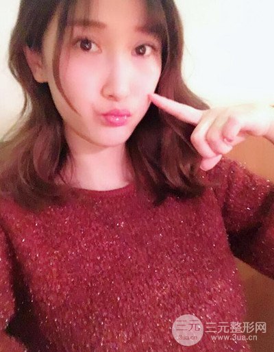 蘇州美貝爾假體隆胸案例，對(duì)比圖恢復(fù)過(guò)程分享~