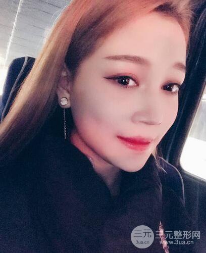 【下頜角+顴骨+下巴】全臉磨骨整形，術(shù)后的我人生開掛了！