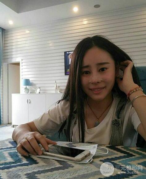 成都華顏賈德淵隆鼻失敗修復(fù)真實案例分享，并且附上前后對比照片