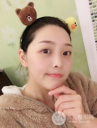 面部吸脂瘦臉手術(shù)日記分享，瘦臉果驚人