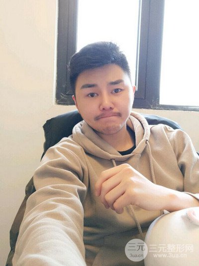 成都玉之光黃開亮醫(yī)生隆鼻修復(fù)整形案例，前后恢復(fù)過程分享