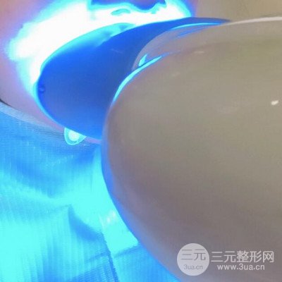 做了牙齒冷光美白果很棒，綻放美麗笑容