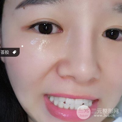 做了牙齒冷光美白果很棒，綻放美麗笑容