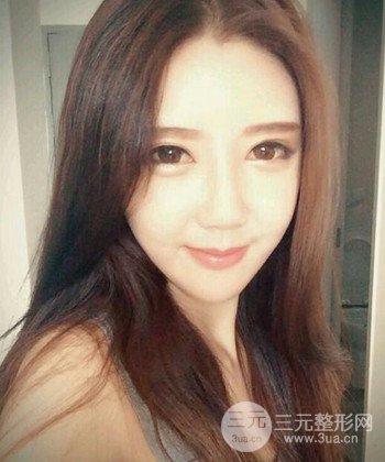 全臉自體脂肪填充手術(shù)日記分享，改良臉型年輕十歲