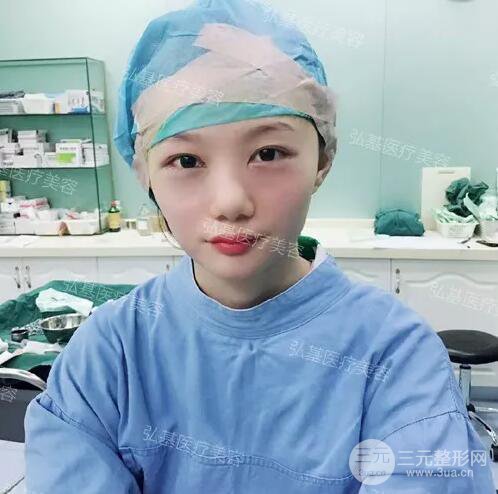 廣州弘基醫(yī)療美容祛眼袋案例,看看她是怎么變美的！