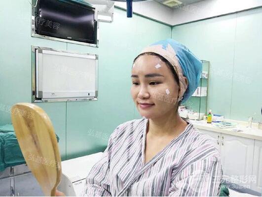 廣州弘基醫(yī)療美容自體脂肪填充案例