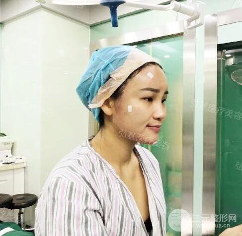 廣州弘基醫(yī)療美容自體脂肪填充案例