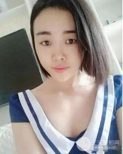 成都玉之光自體脂肪面部填充劉中國真人案例反饋|內附對比前后照