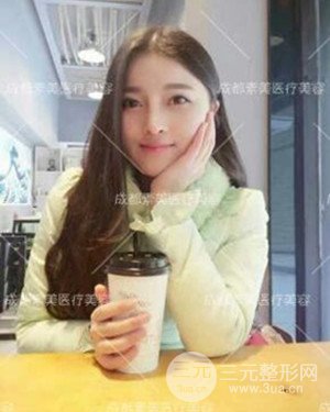 成都素美假體隆鼻案例前后對比圖分享!