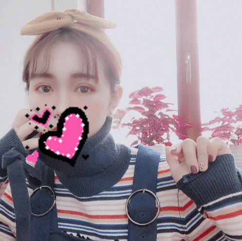 揚(yáng)州艾菲斯黃嬋雙眼皮案例術(shù)后恢復(fù)果