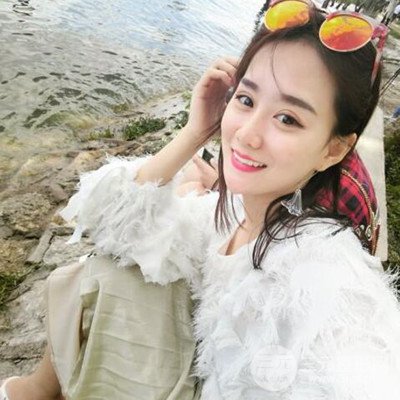 廣州韓妃李光琴隆鼻失敗修復(fù)前后對比圖分享！