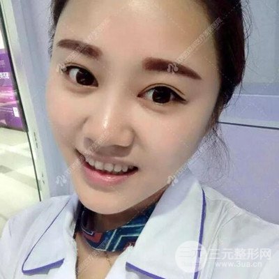 沈陽(yáng)百嘉麗汪曉蕾自體脂肪面部填充恢復(fù)記錄案例分享~