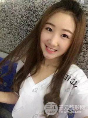 沈陽杏林史靈芝醫(yī)生隆鼻整形案例日記分享~