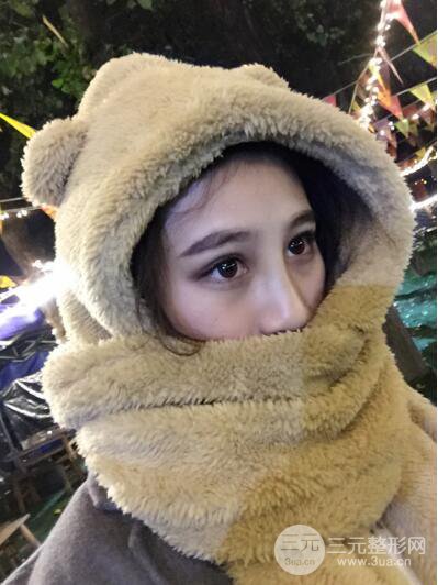 貴陽麗都李觀龍隆鼻整形案例對(duì)照?qǐng)D一個(gè)月恢復(fù)過程分享