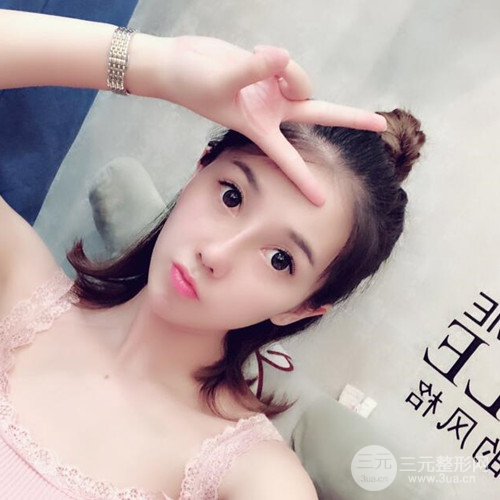 重慶五洲范文亮自體肋軟骨隆鼻案例前后對(duì)比圖分享~