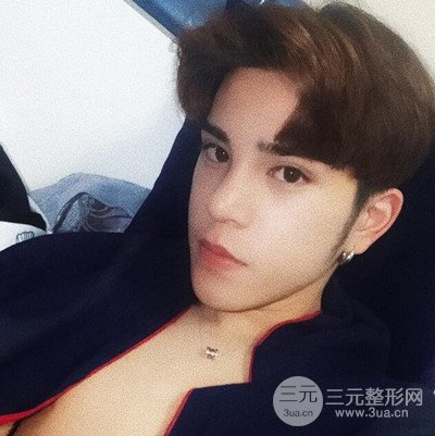 成都蜀尚蓉雅陳建華隆鼻整形前后對(duì)比照分享~