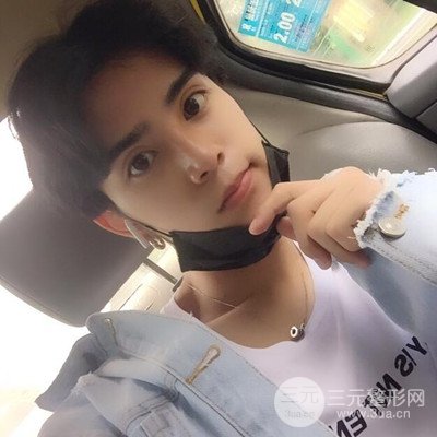 成都蜀尚蓉雅陳建華隆鼻整形前后對(duì)比照分享~