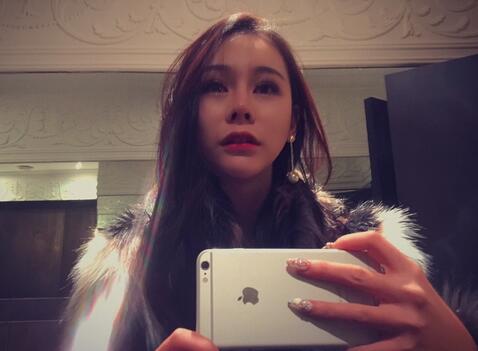 成都天使之翼做隆鼻整形改變了我的塌鼻子 果真的很不錯