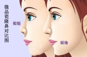 南昌佳美整形醫(yī)院價格表一覽爆出