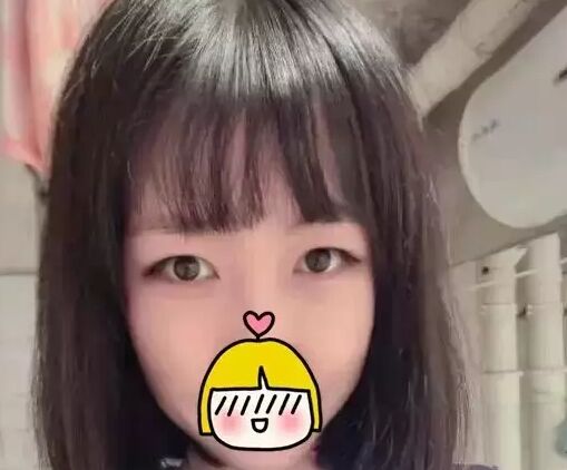 雙眼皮修復(fù)需要慎重 可是我幸運(yùn)的修復(fù)好了雙眼皮