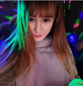 做完開眼角之后眼睛變大也超自然