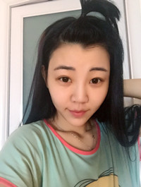 開外眼角手術(shù)前后過程對比圖片