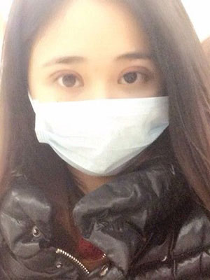 北京常好麗格割雙眼皮一周啦~