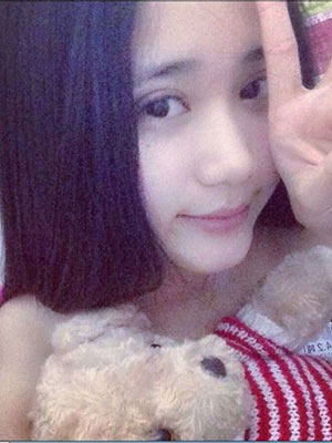 北京常好麗格割雙眼皮一周啦~