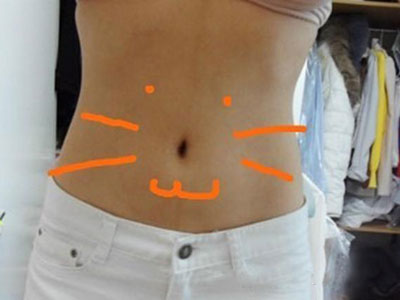 北京常好麗格腰腹吸脂后20天的感受 恢復日記來咯~