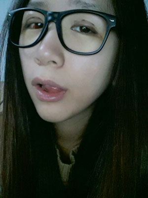 北北京常好麗格三點(diǎn)定位雙眼皮恢復(fù)一個(gè)月經(jīng)歷