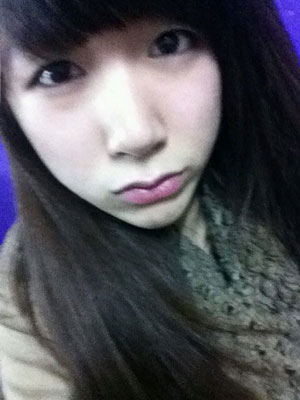 北北京常好麗格三點(diǎn)定位雙眼皮恢復(fù)一個(gè)月經(jīng)歷