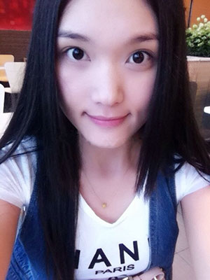 北京常好麗格做假體隆鼻3個月