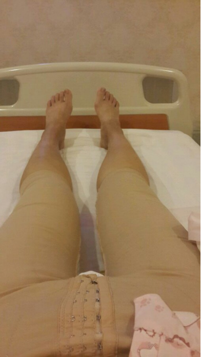 水動(dòng)力吸脂瘦大腿讓我夏天放肆嗨