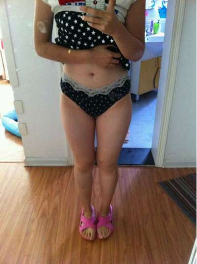 水動(dòng)力吸脂瘦大腿讓我夏天放肆嗨