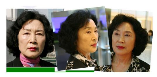 拉皮除皺手術(shù)讓我年輕20歲