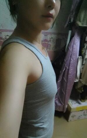 成都艾米麗自體脂肪隆胸三個月啦~