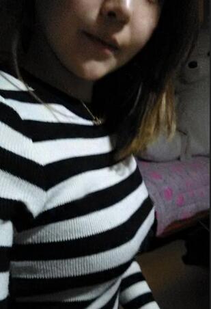 成都艾米麗自體脂肪隆胸三個月啦~