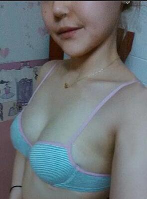 成都艾米麗自體脂肪隆胸三個月啦~