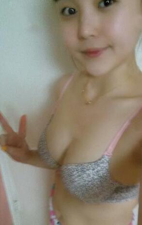 成都艾米麗自體脂肪隆胸三個月啦~